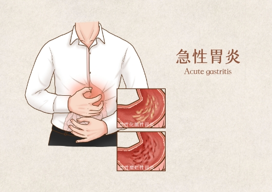 胃腸動(dòng)力治療儀