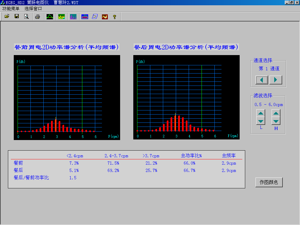 EGEG-8D八導(dǎo)胃腸電圖儀(圖2)