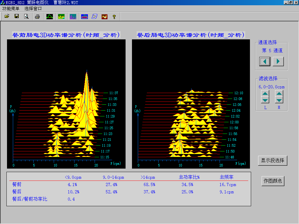 EGEG-8D八導(dǎo)胃腸電圖儀(圖3)