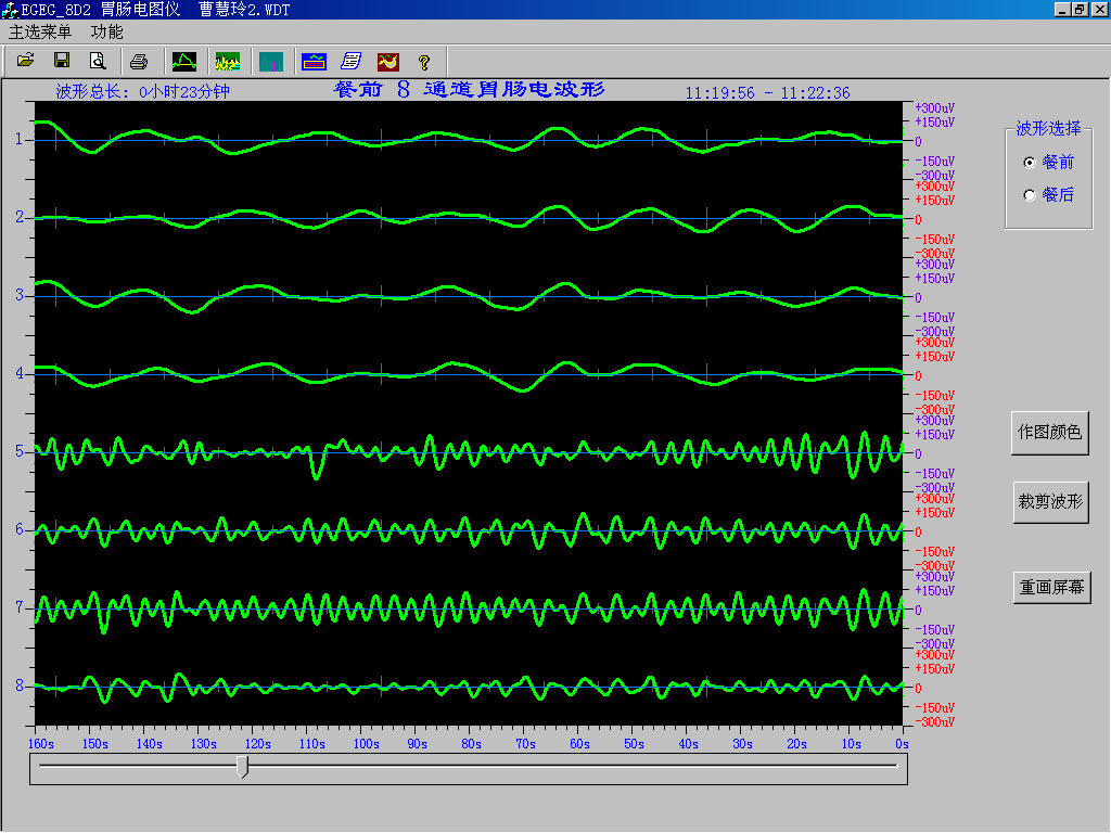 EGEG-8D八導(dǎo)胃腸電圖儀(圖5)