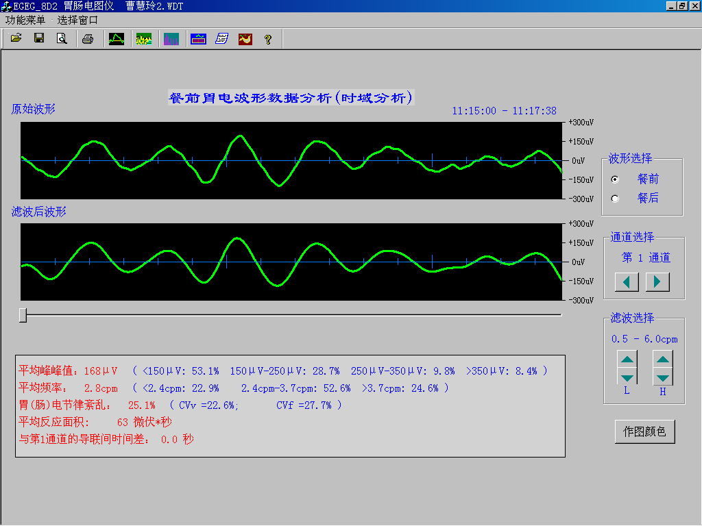 EGEG-8D八導(dǎo)胃腸電圖儀(圖1)