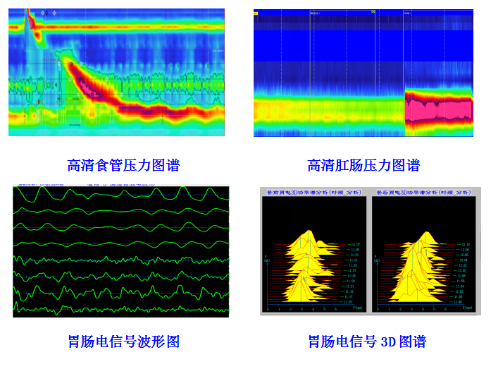 XDJ-S8CT型消化道動力檢測儀(圖1)